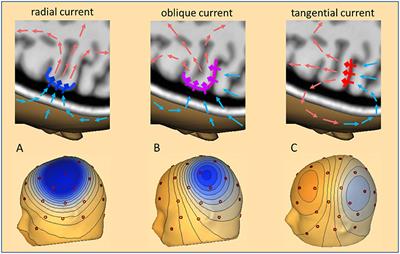 Taking the EEG Back Into the Brain: The Power of Multiple Discrete Sources